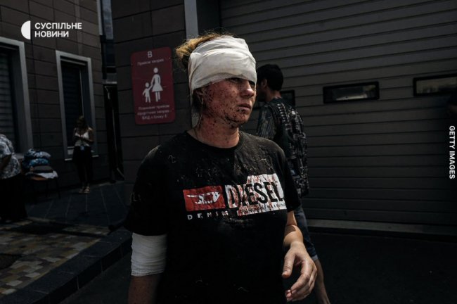 Після прильоту з «Охматдиту» у Києві евакуюють дітей: жахливі кадри з лікарні 