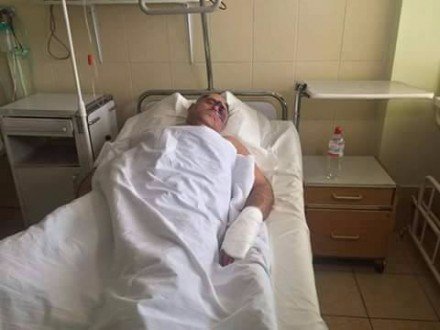 В Одесі жорстоко побили «оппоблоківця»