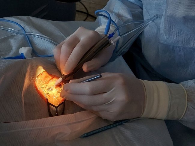 Офтальмологічні операції тепер проводять і у Володимирі.ФОТО 