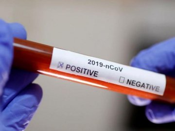  В Україні – перша смерть від коронавірусу