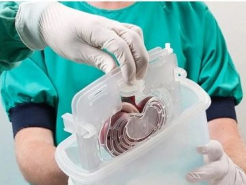 В Україні змінили закон про трансплантацію органів