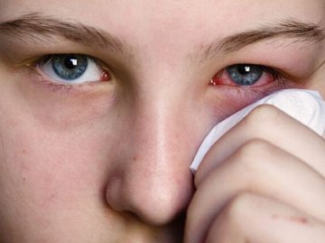  Як розпізнати вірусний кон'юнктивіт? Симптоми захворювання*