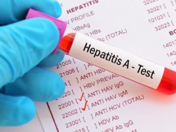 На Волині підліток захворів на гепатит, що передається через продукти і воду