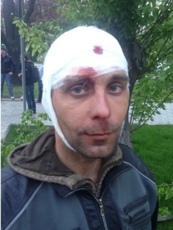 У Донецьку сепаратисти стріляли по учасниках мирного мітингу. ФОТО. ВІДЕО