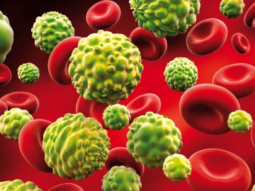 Лучанин здолав непереможну хворобу в закладі для невиліковних