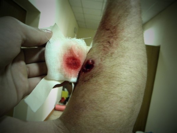 Фото поранених бійців Волинської сотні