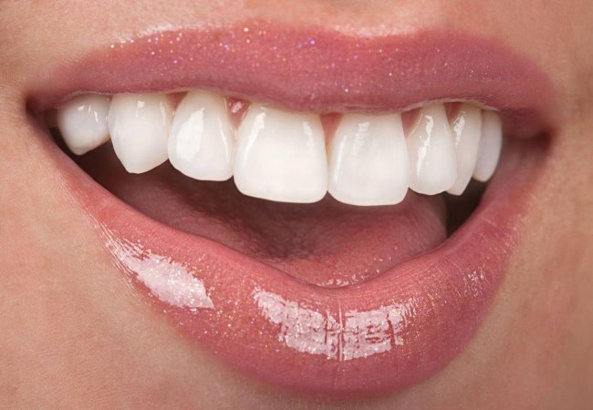 Причини появи напівпрозорості зубів