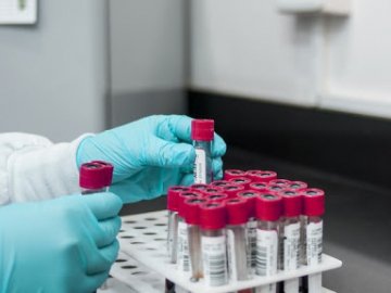 Ранок 9 вересня: в Україні –  2 551 новий випадок коронавірусу за добу, на Волині – 72