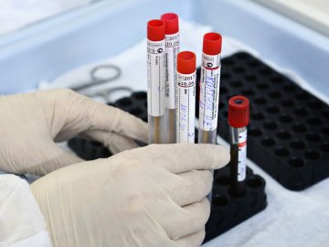 На Волині одужало двомісячне немовля, яке хворіло на коронавірус