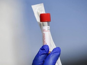 У районі на Волині – новий випадок коронавірусу