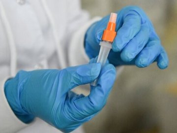 За тиждень на Волині на COVID-19 захворіли майже пів тисячі людей