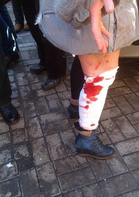 Фото сутичок під Верховною Радою