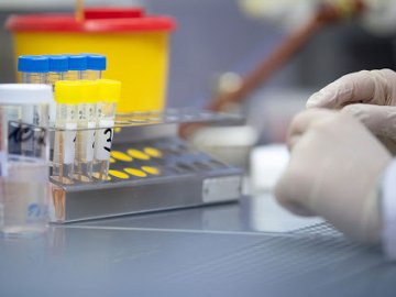 Ранок 21 липня: в Україні – 673 нових випадки коронавірусу, на Волині – 37