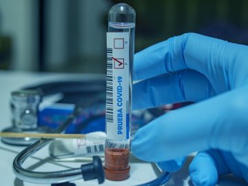 В Україні за добу  – 2 107 випадків коронавірусу, з них на Волині – 37