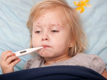 Кір на Волині: кількість хворих зросла