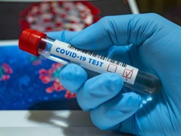 В Україні за добу виявили 14 490 нових випадків COVID-19, померло 403 людини