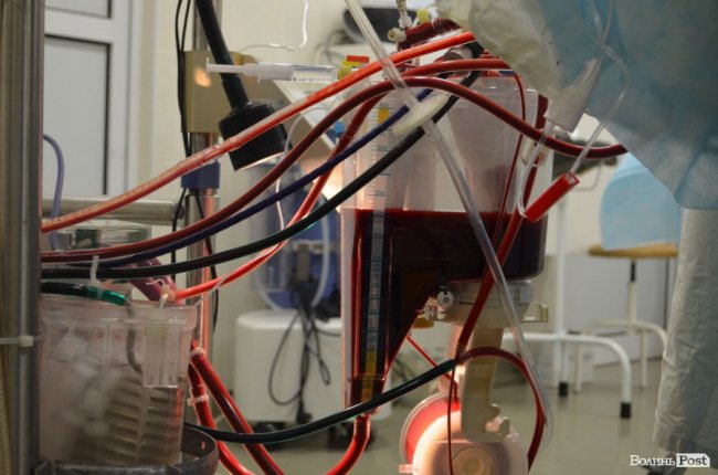 Другий шанс на життя: як у Луцьку оперують на відкритому серці. ФОТО 18+