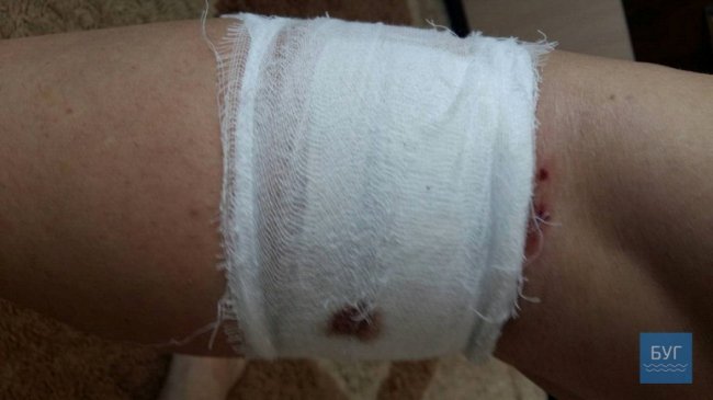 У Нововолинську біля монастиря на людей напала зграя собак