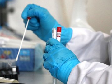 В Україні зафіксували понад 25 тисяч нових випадків коронавірусу: на Волині – 466