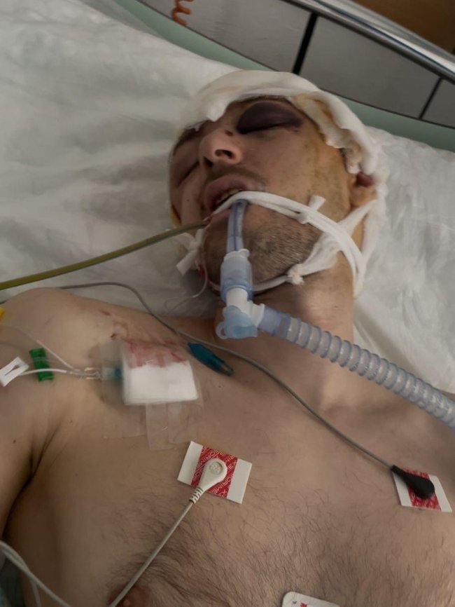 У Луцьку чоловік після затримання ТЦК потрапив у реанімацію