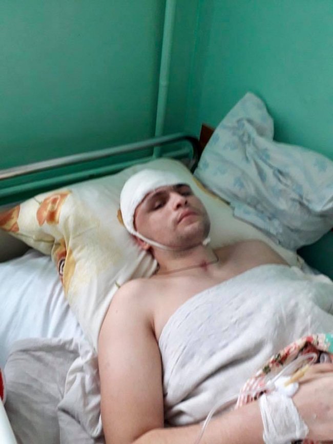 Волинського атовця, якому збирали кошти на титанову пластину, прооперували. ФОТО