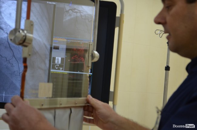 У Луцьку робитимуть унікальні операції на судинах. ФОТО