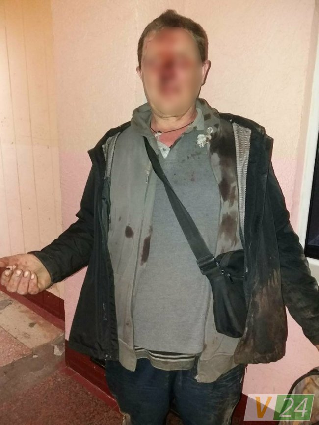 У Луцьку група молодиків побила чоловіка через «відмову закурити» 