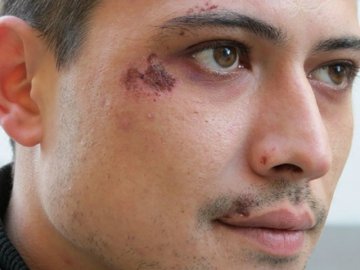 У Львові жорстоко побили журналіста і його дружину. ВІДЕО