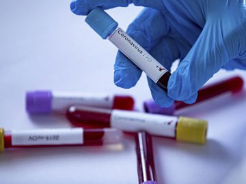 124 нових випадки і одна смерть: ситуація з коронавірусом на Волині за минулу добу 