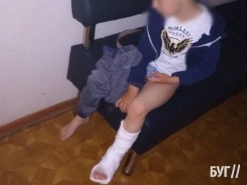 У парку в Нововолинську велосипедистка збила і травмувала дитину