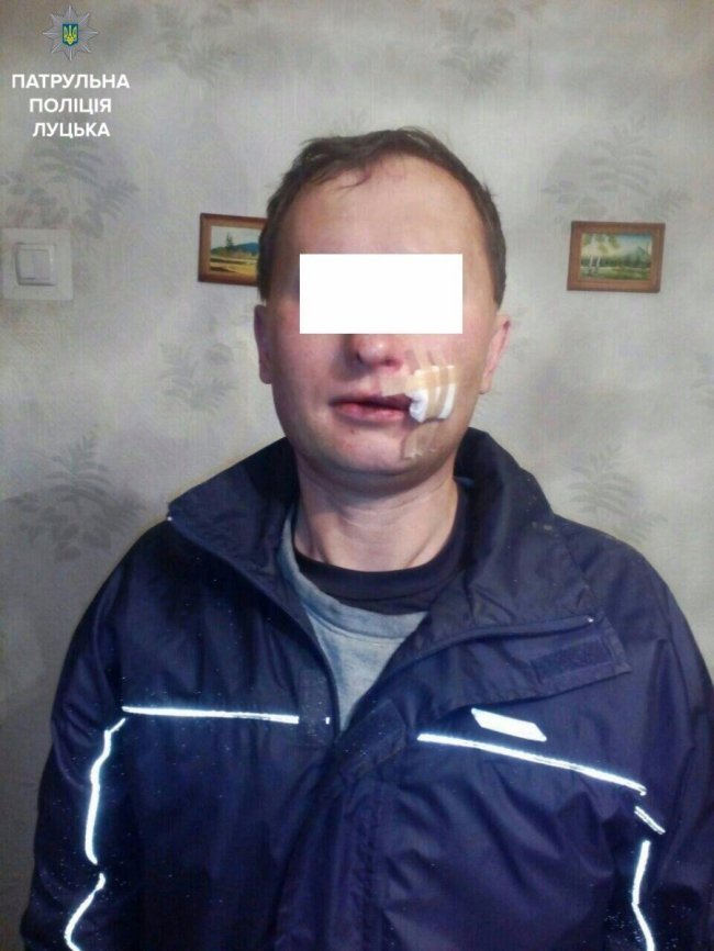 У Луцьку підлітки побили чоловіка, який прийшов на побачення до їхніх подруг