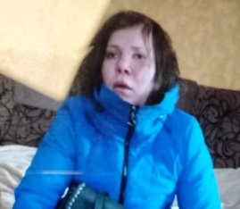 На Волині поліція розшукує безвісти зниклу 33-річну жінку. ФОТО