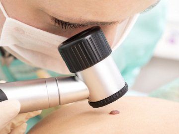 Жителі Нововолинська безкоштовно зможуть обстежити родимки: прийматиме дерматолог з Луцька