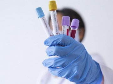 Ранок 9 червня: в Україні – 394 нових випадків коронавірусу за добу, на Волині – 34