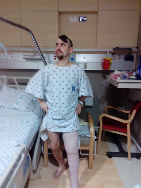 Герой з Волині, який лікується в Ізраїлі, зміг стати на ноги. ФОТО