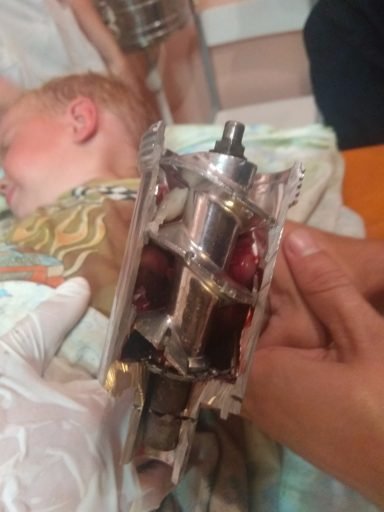 На Донеччині рука 2-річної дитини застрягла в електром’ясорубці 