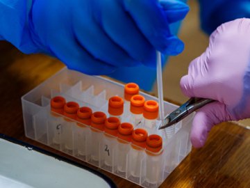 Коронавірус на Волині: повідомили про ситуацію за минулу добу