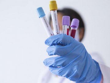 Де на Волині виявили нові випадки коронавірусу станом на ранок 5 червня 