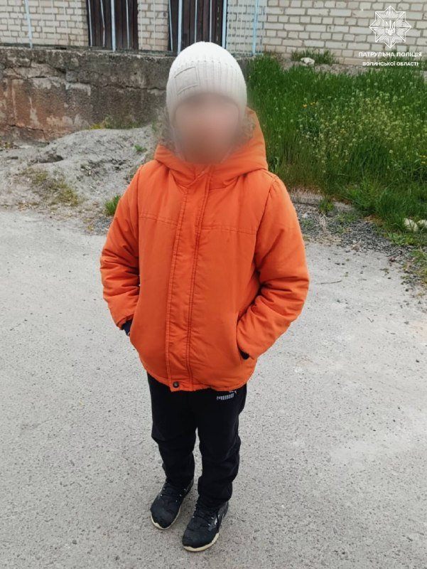 Гематоми на обличчі та на шиї: у Луцьку мати застосовувала до сина-третьокласника фізичну силу