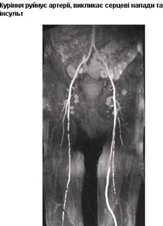 Якими малюнками на пачках цигарок лякатимуть курців. ФОТО