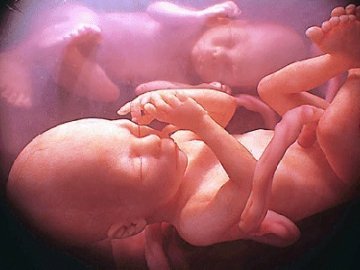 Католики просять депутатів заборонити аборти