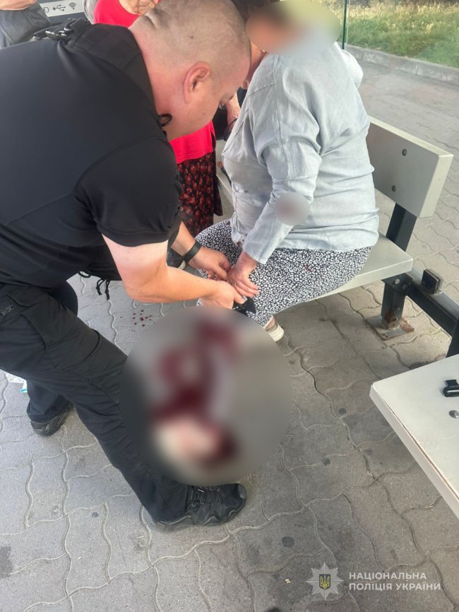 У Луцьку жінка впала біля маршрутки, з ноги почалась масивна кровотеча: поліцейські врятували їй життя