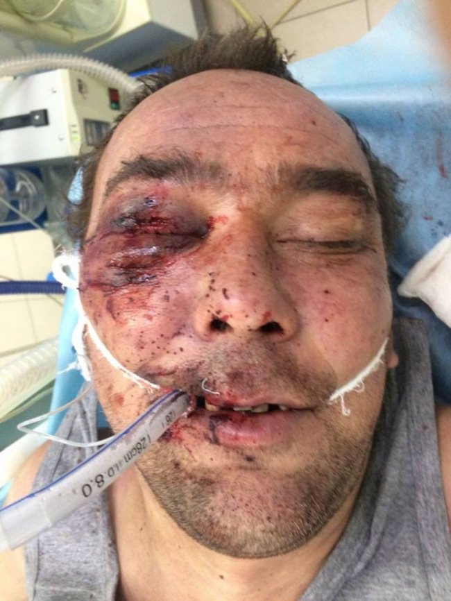 Волинян просять розпізнати чоловіка, якого збило авто. ФОТО 18+