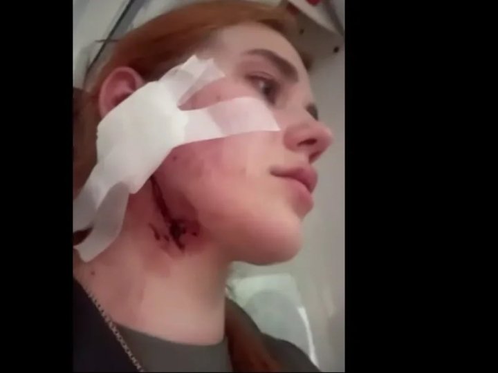 МЗС закликає польських правоохоронців негайно відреагувати на побиття українців у Вроцлаві
