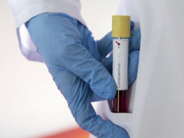 У Львові від коронавірусу померла завідувачка лабораторного центру