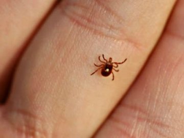 Луцька лікарка розповіла, як правильно без шкоди для здоров'я витягнути кліща