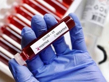 На Волині – рекордна кількість хворих на коронавірус за добу, 22 людини померли