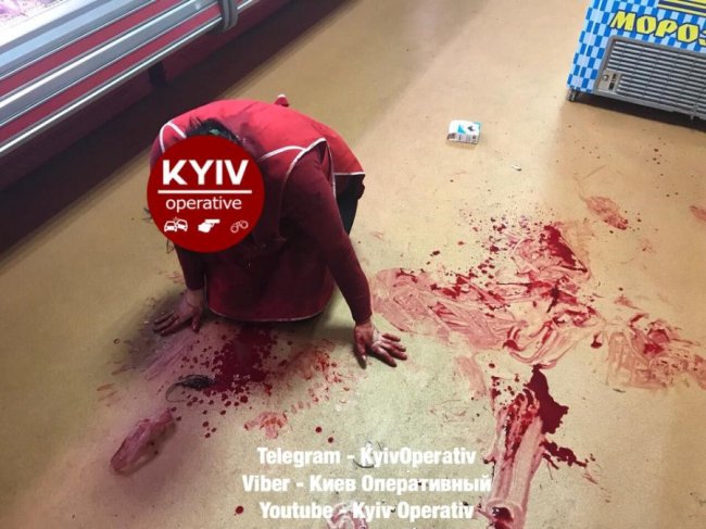 У Києві чоловік з ножем порізав жінку-продавчиню. ФОТО 18+