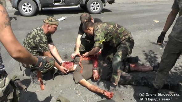 Пекло за життя: фоторепортаж бійця АТО. ФОТО