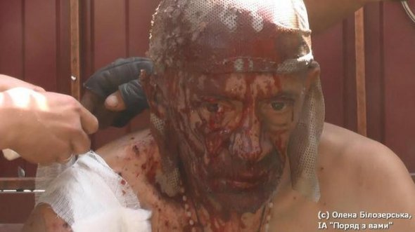 Пекло за життя: фоторепортаж бійця АТО. ФОТО